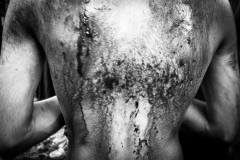 Blood soaked back of a mourner after performing 'tatbir' or self-flagellation at a 'maatam' procession.